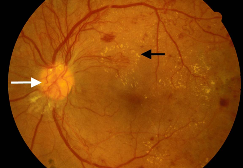 Image Bank in Ophthalmology