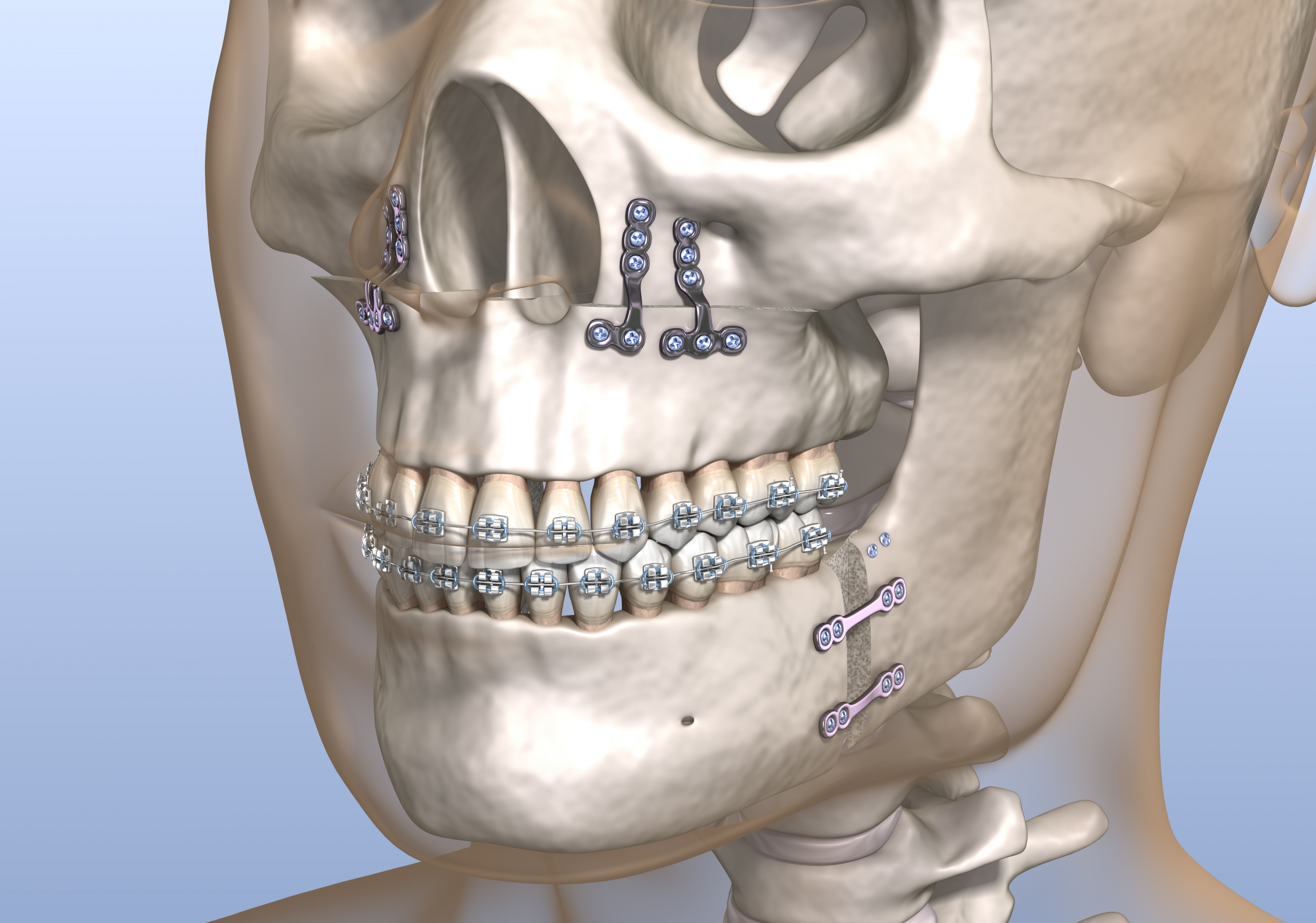 ORAL SURGERY