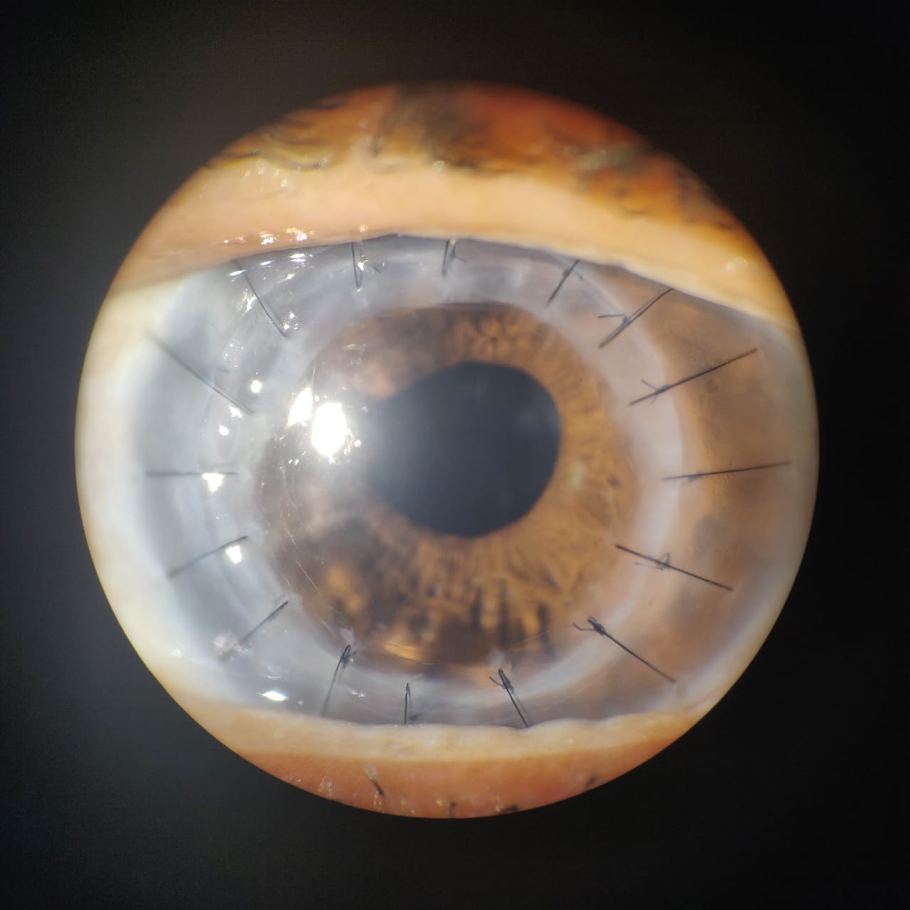 Cornea & Conjunctiva