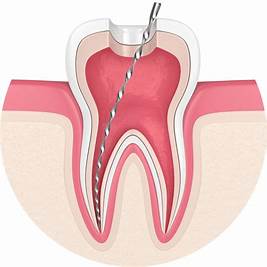 OPERATIVE DENTISTRY 