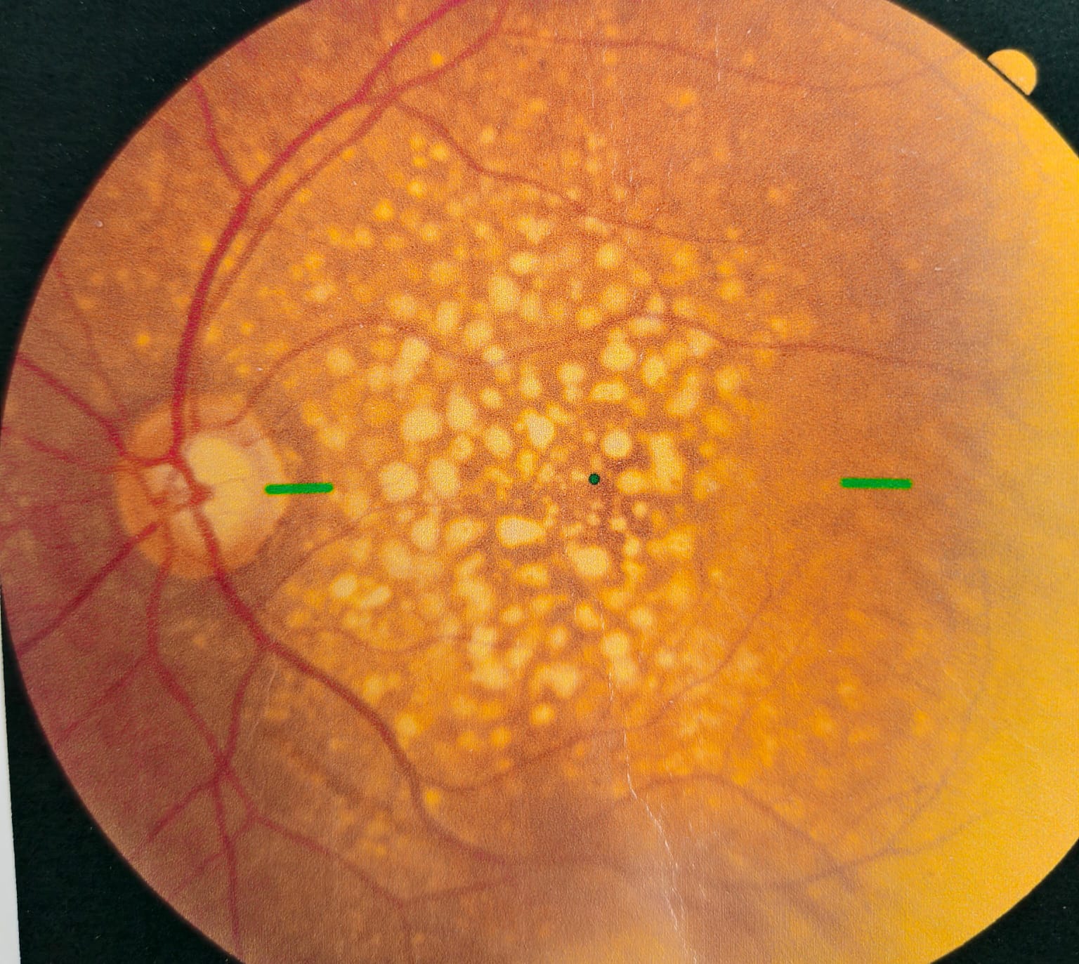 Comprehensive course for Undergraduates/NEET PG/ INICET
