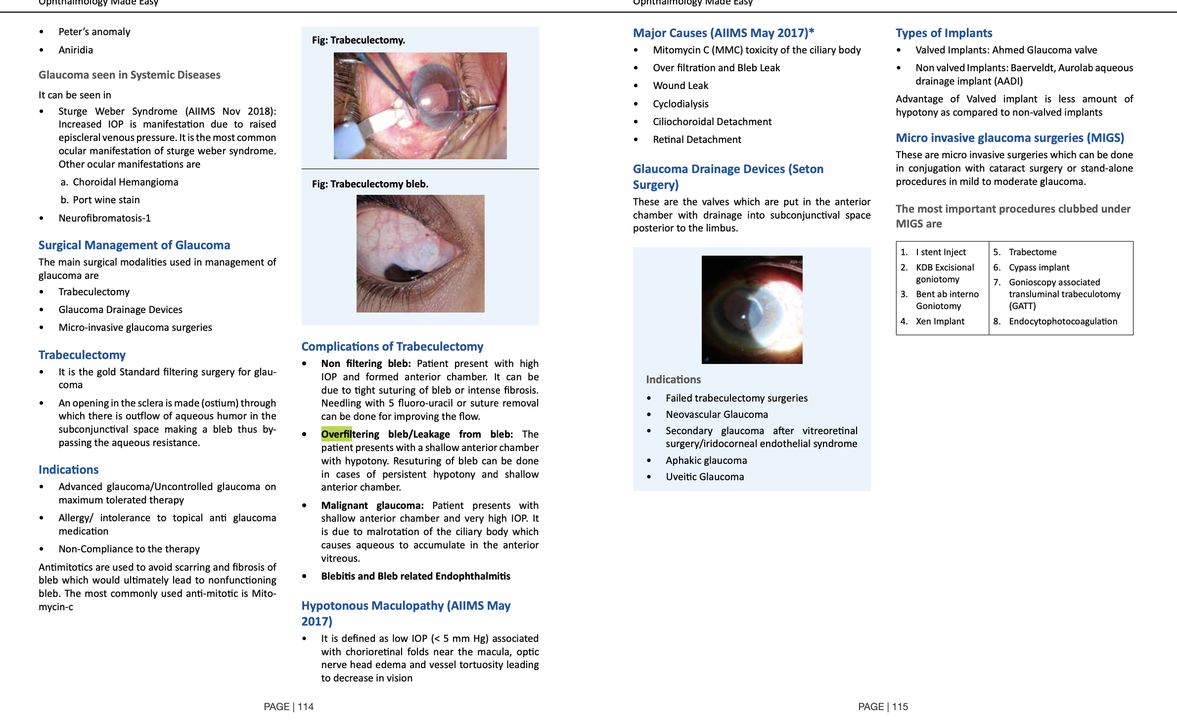 Handbook of Glaucoma