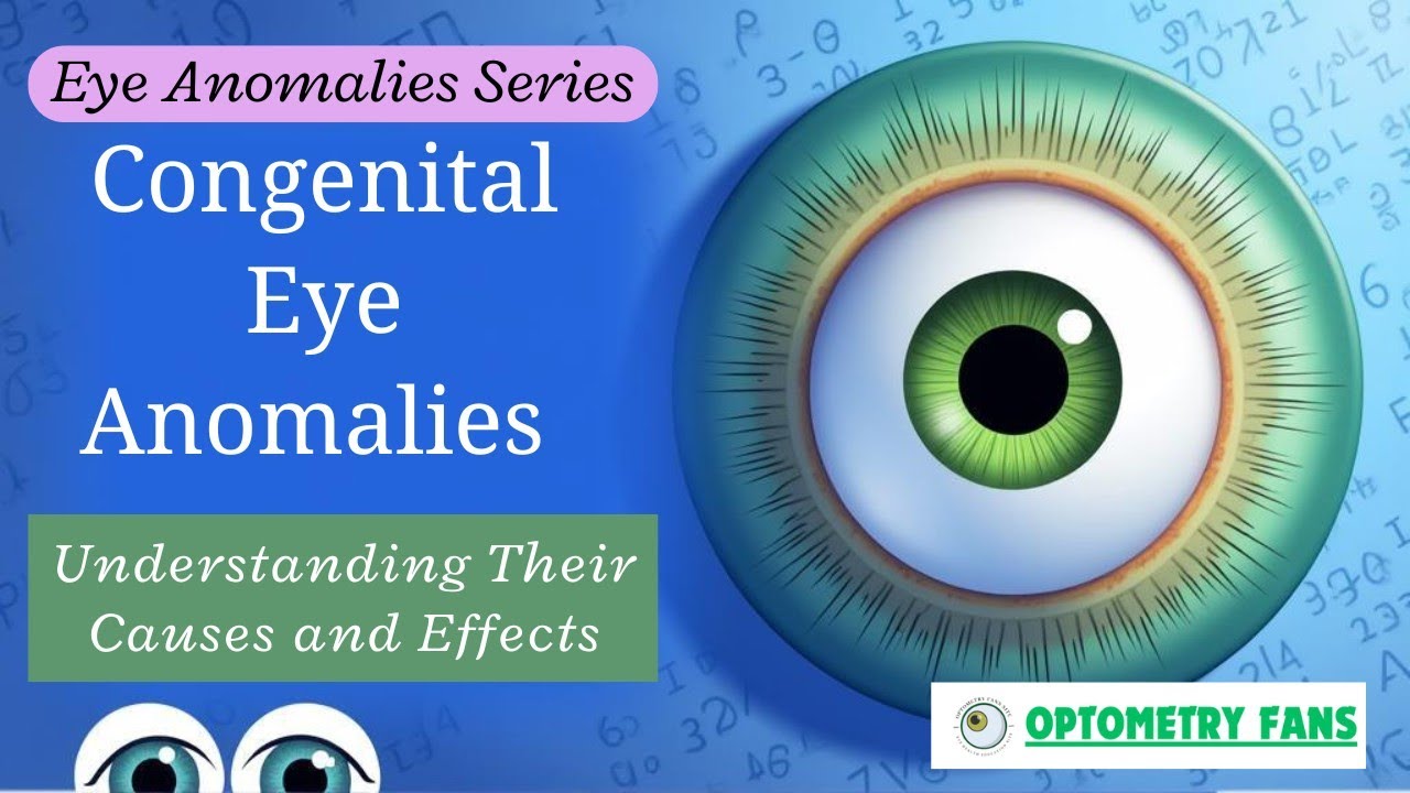 CONGENITAL ANOMALIES OF EYE