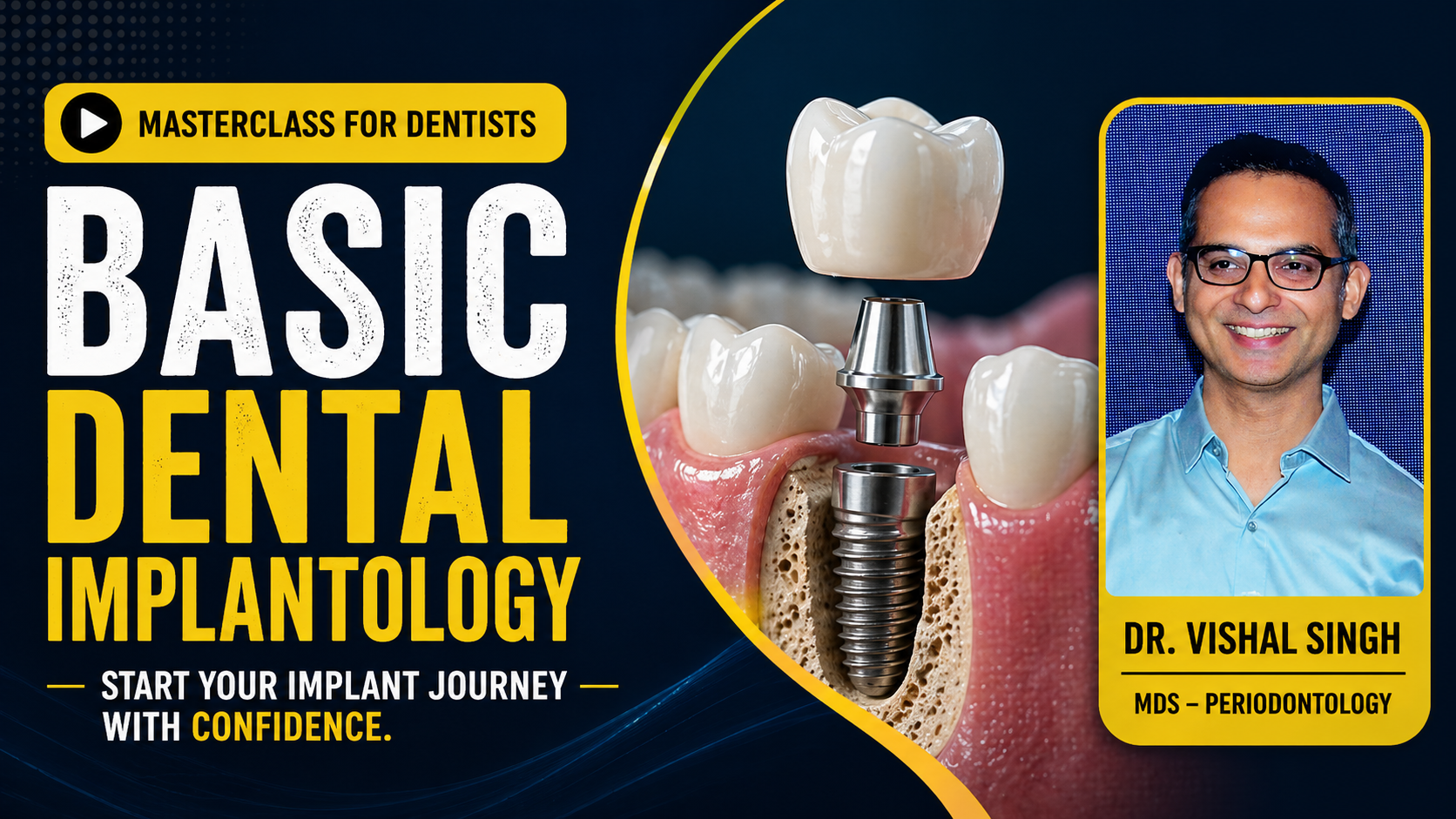 Basic Dental Implantology — Start Implant Practice Confidently | Beginner Foundations