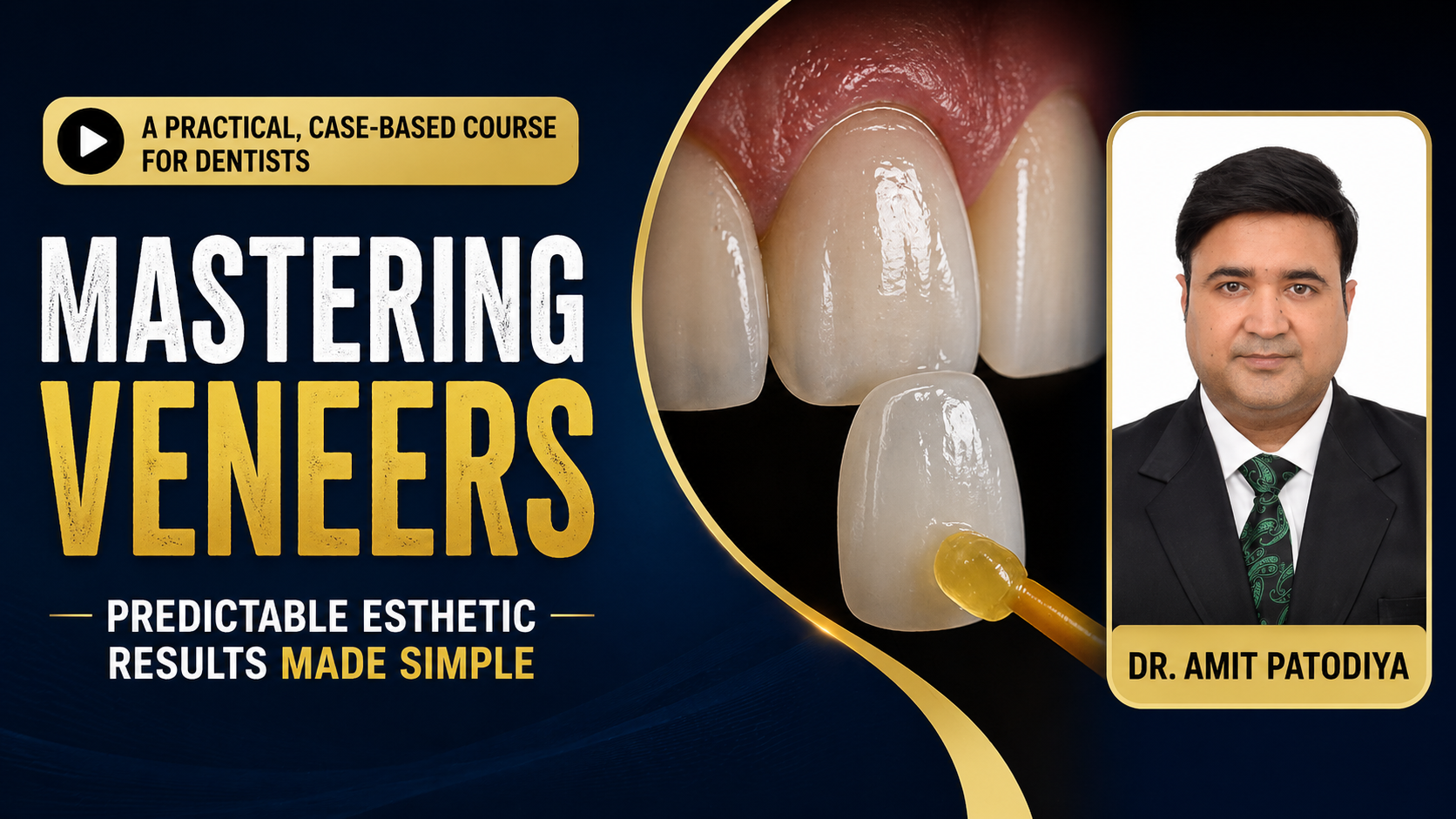 ABCD : Veneers