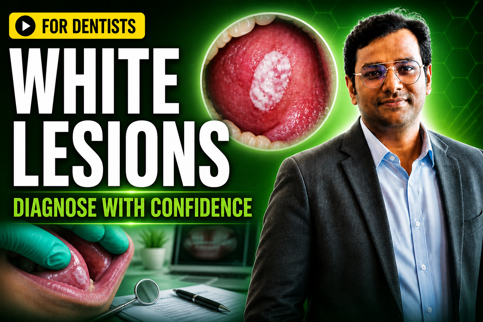 White Lesions of the Oral Cavity – A General Practitioner’s Enigma - Case Based Learning
