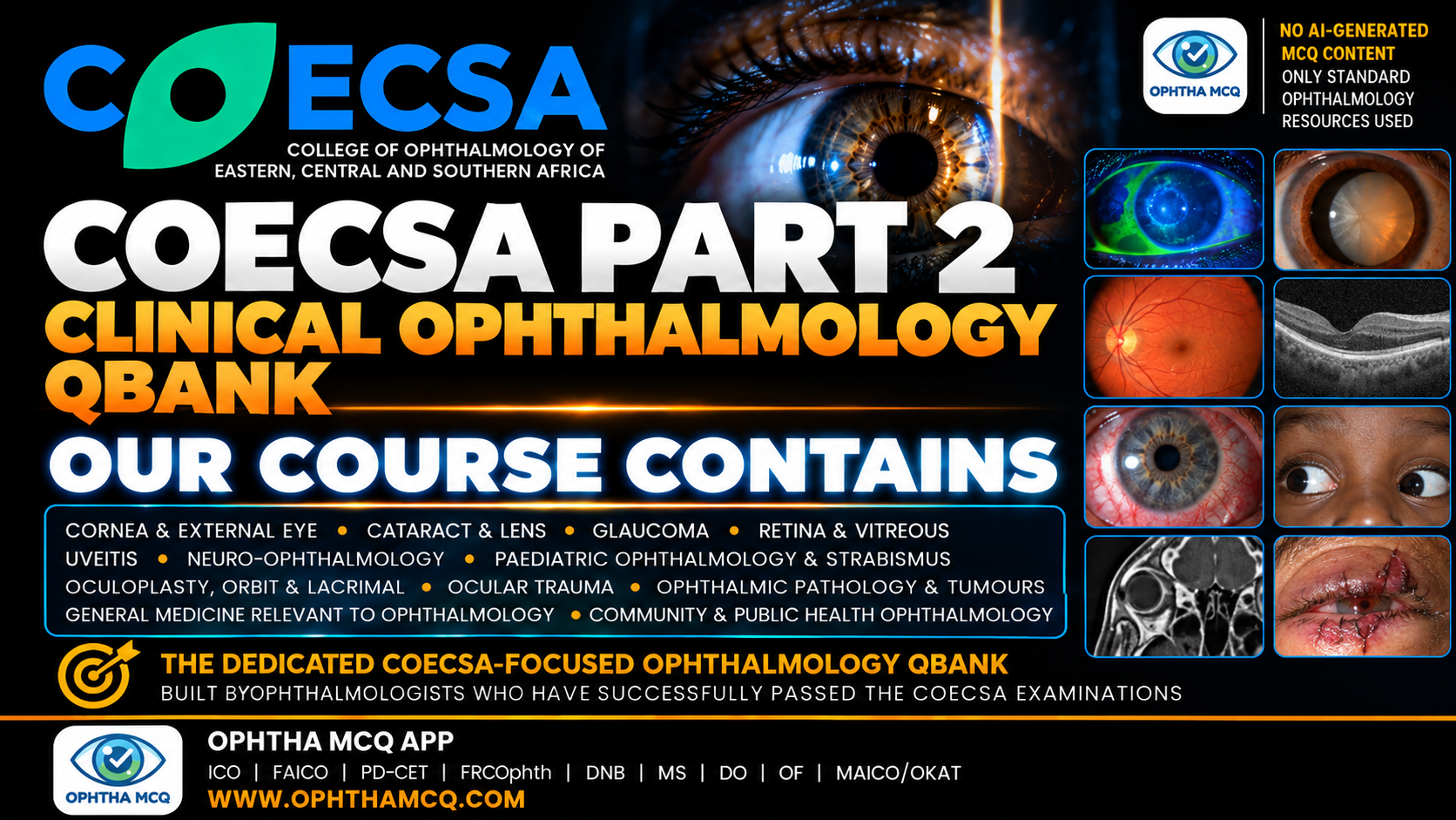COECSA PART 2 – CLINICAL OPHTHALMOLOGY QBANK