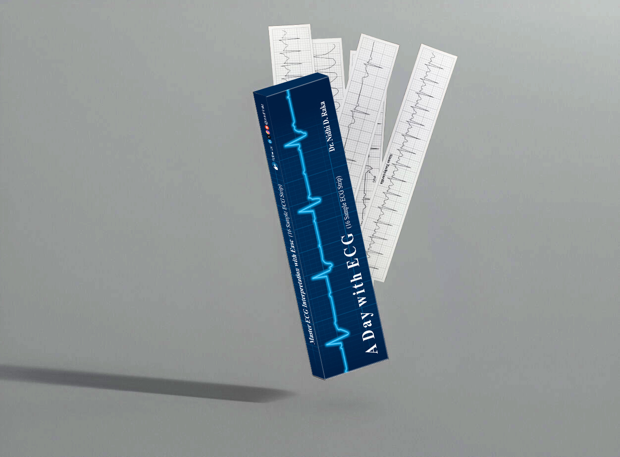 ECG Strips