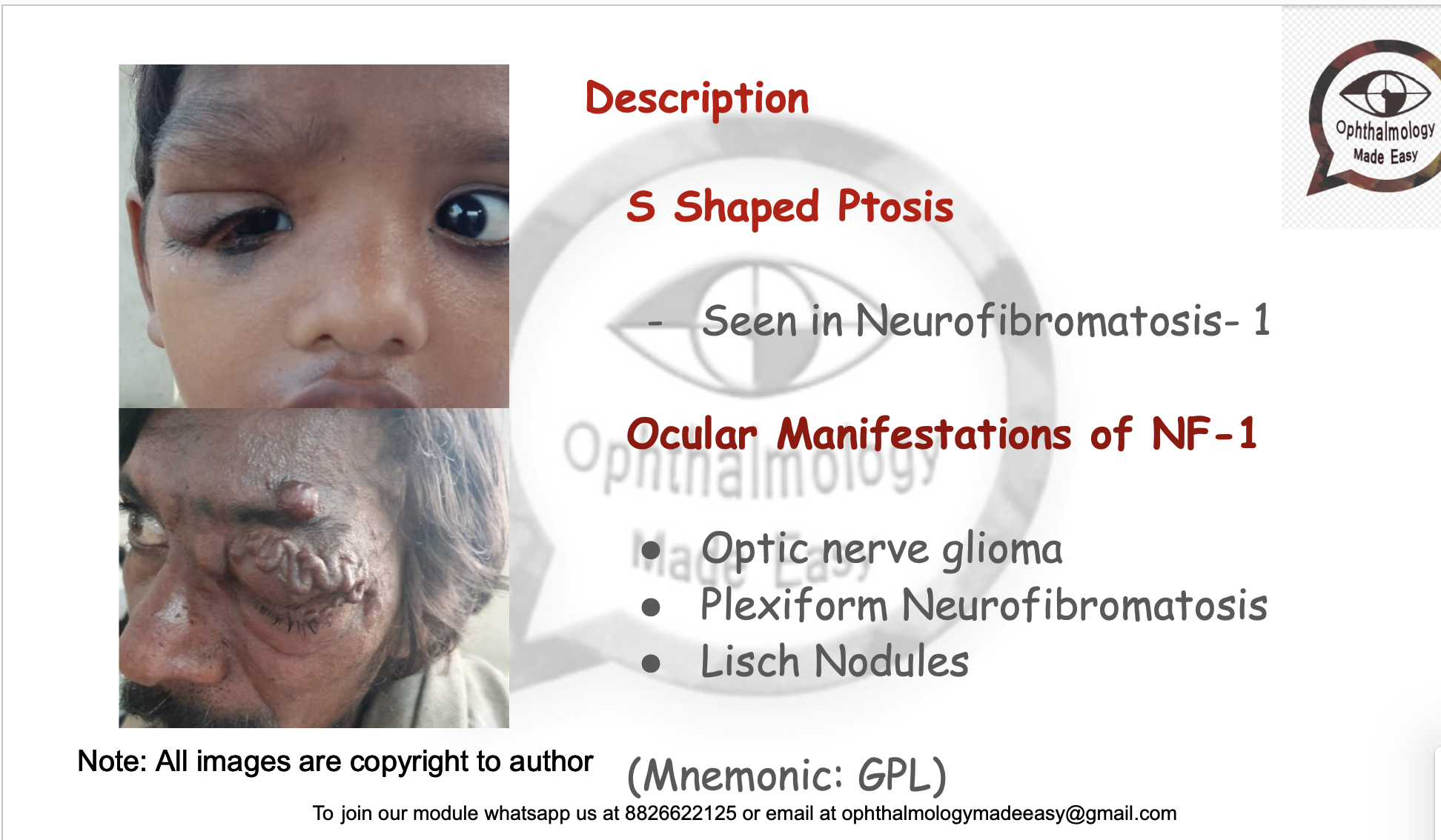 Systemic Ophthalmology