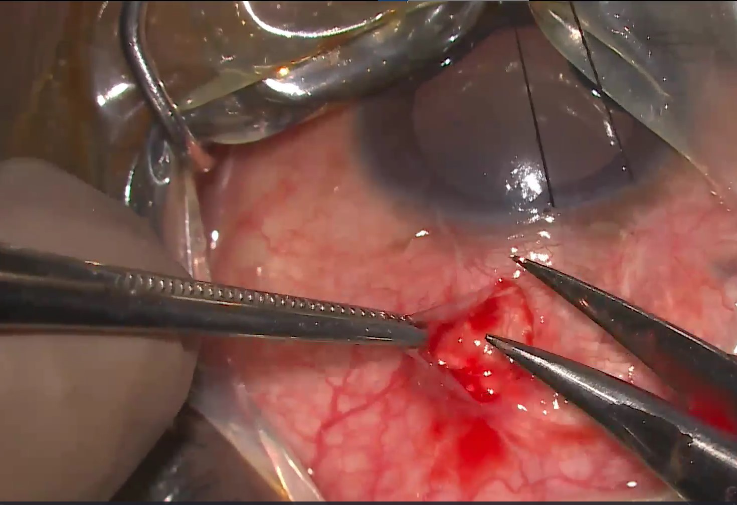 Ophthalmology Q Bank for Residents/Fellows