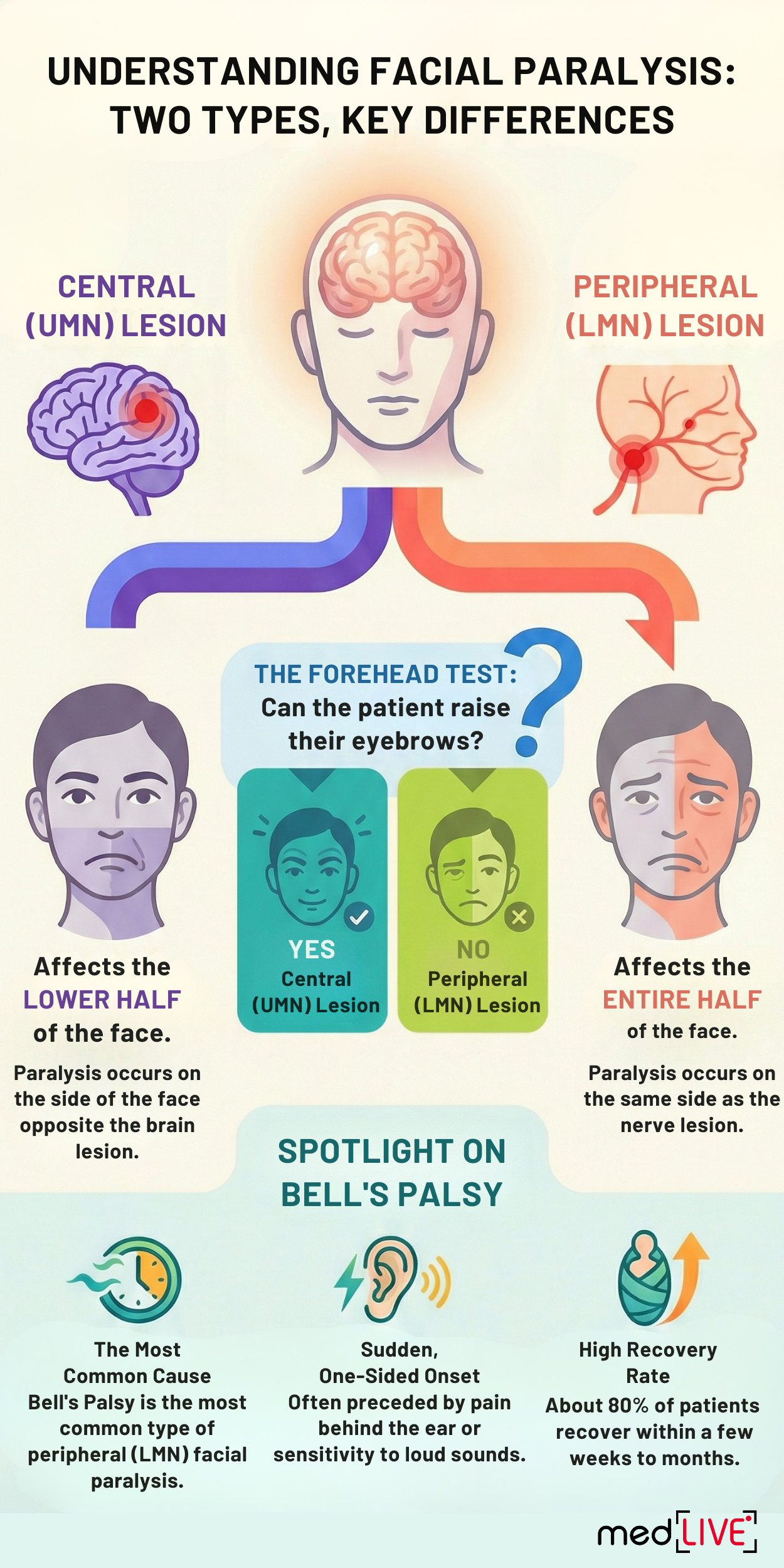 Facial Nerve Disorder E02