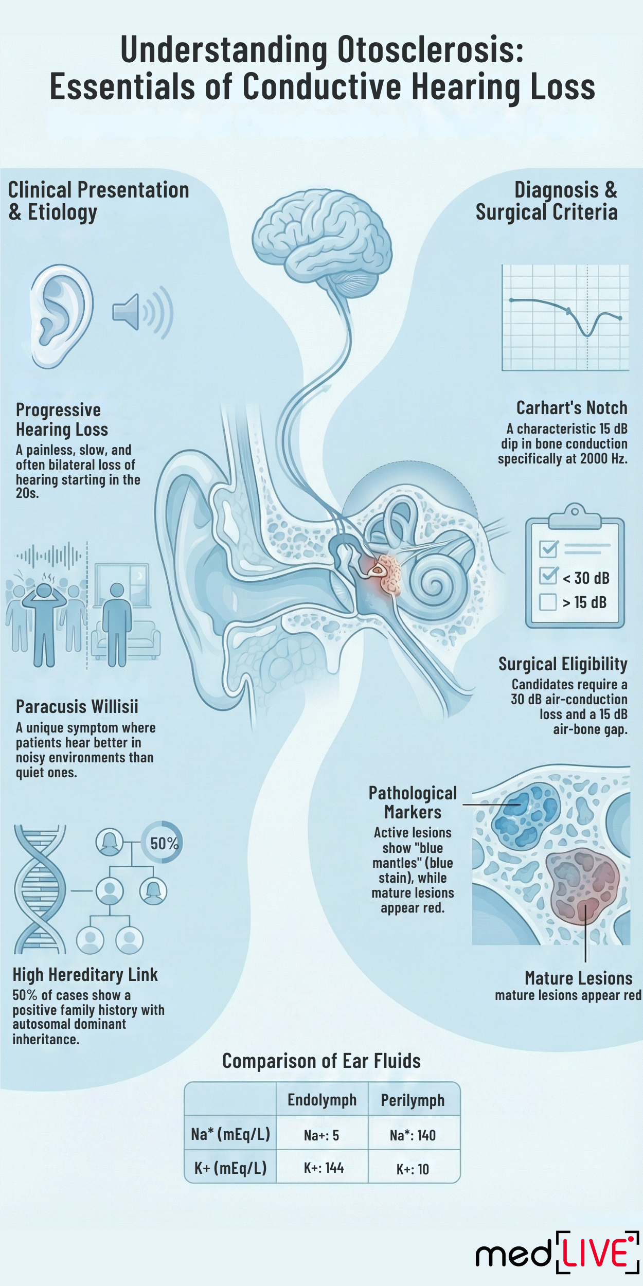 Otosclerosis