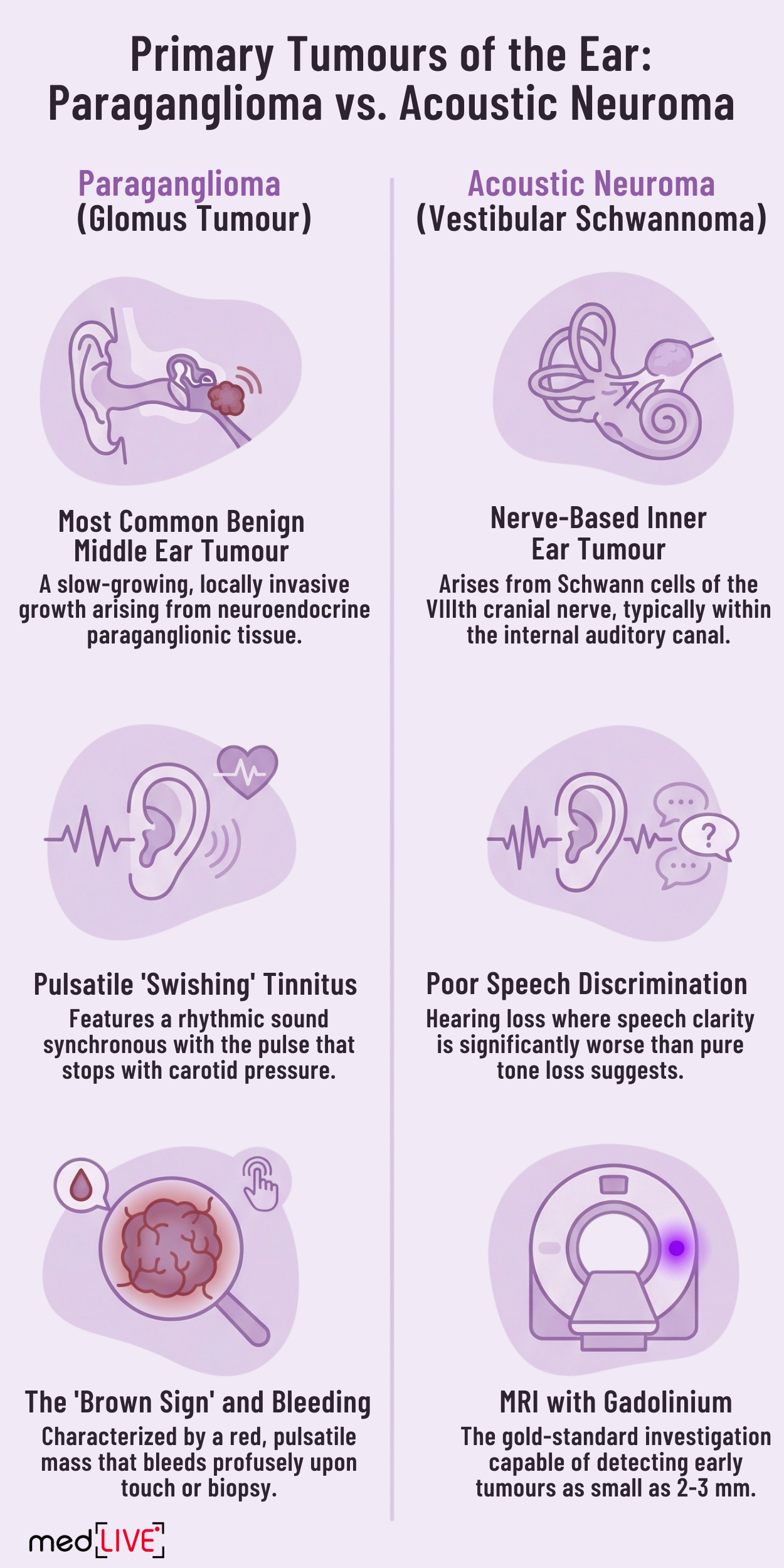 Tumours of Ear